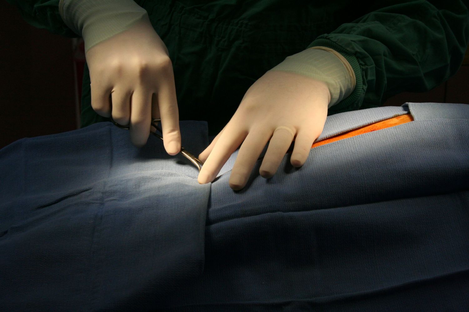 http://www.lifeline.de/img/untersuchungen-lexikon/origs152629/8859478308-w1500-h1500/Biopsie.jpg
