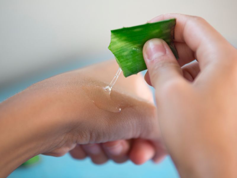 Aloe vera als beliebtes Hausmittel bei Sonnenbrand