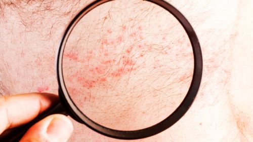 Skin rash: what disease is behind it?