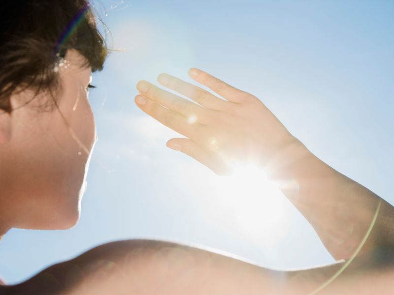 Homöopathie bei Sonnenbrand