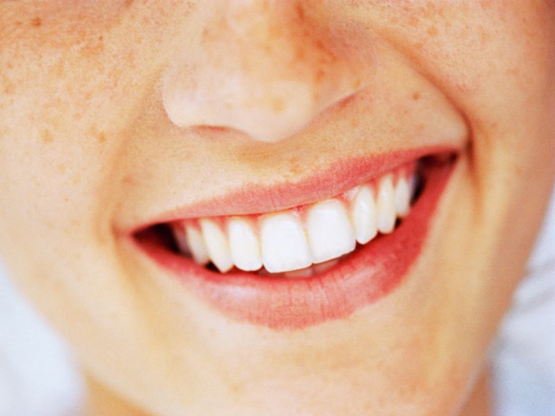 Schöne Zähne durch Vitamin D