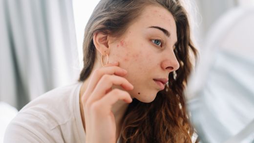 Rash from stress.jpg