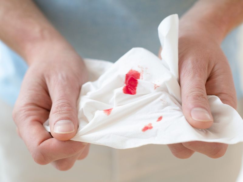Blut im Stuhl ist Symptom bei Hämorrhoiden