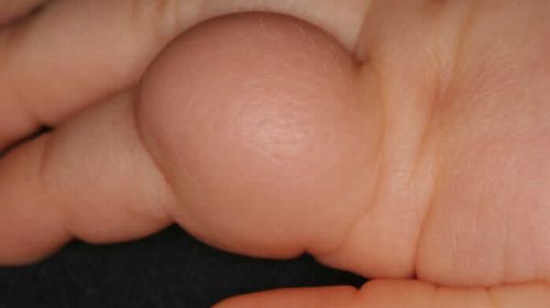Identificar las enfermedades de la piel en los niños.