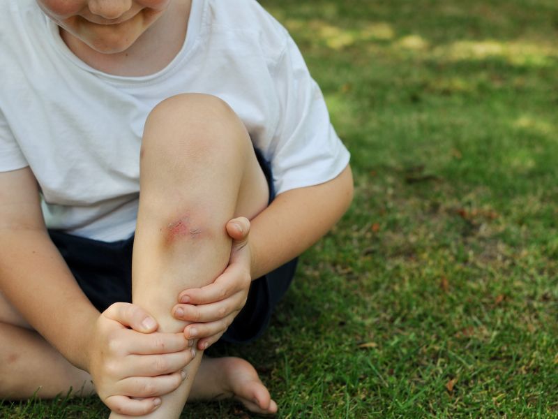 Homöopathie für Kinder: Arnica