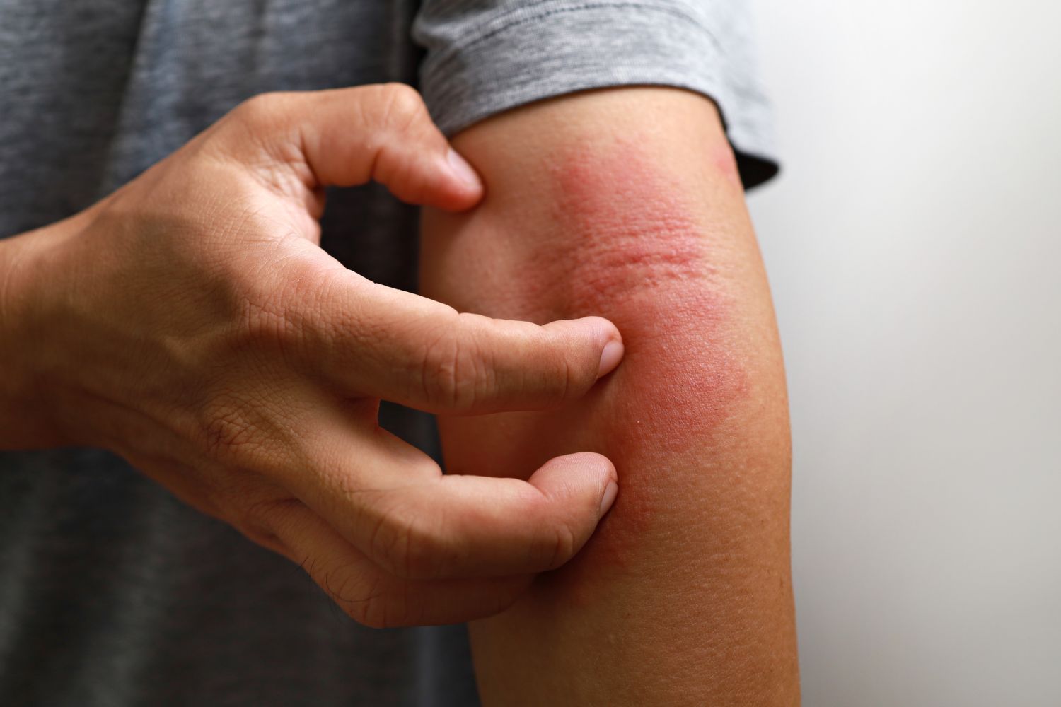 “Zinc Deficiency and Its 11 Possible Symptoms: Importance and Solutions”