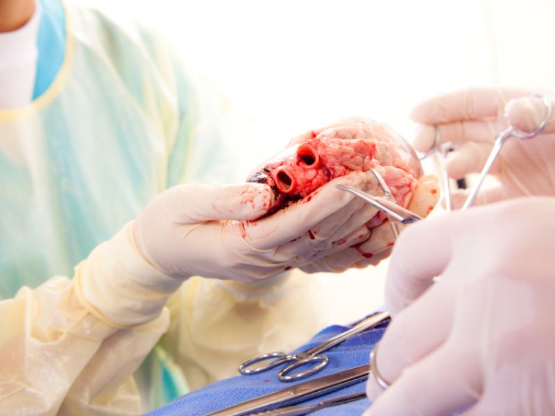 Nach dem Hirntod können Niere, Herz, Leber, Lunge, Bauchspeicheldrüse und Dünndarm entnommen und transplantiert werden. Es gibt auch Lebendspenden, etwa von Nieren. Als Gewebespende bezeichnet man die Spende von Hornhaut der Augen, Teilen der Haut, Herzklappen und Teilen der Blutgefäße, des Knochengewebes, des Knorpelgewebes und der Sehnen. Einige wenige Gewebespenden können auch Lebendspenden sein. Im Organspendeausweis kann man bestimmte Organe zur Spende freigeben oder einzelne Organe von der Spende ausschließen. Welche Organe und Gewebe können gespendet werden?