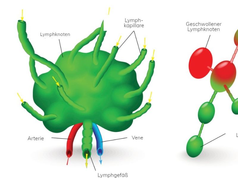 Aufgaben der Lymphknoten