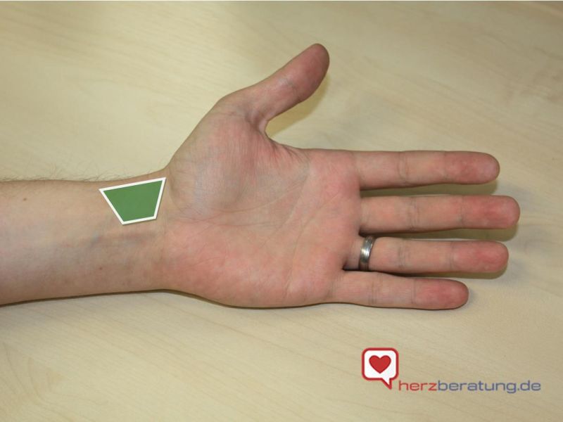 Der Puls am Handgelenk wird an der Radialis-Arterie getastet. Diese verläuft auf der Innenseite des Unterarms (palmar). Auf Höhe des Handgelenks liegt die Arteria radialis sehr oberflächlich unter der Haut und kann auf der daumenseitigen Hälfte über dem Ende der Elle (Unterarmknochen) getastet werden. Der richtige Tastbereich ist auf dem Bild grün markiert. Wo liegt der Puls am Handgelenk?