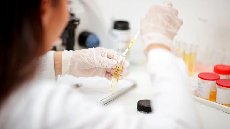 Laborauswertung Dopamin