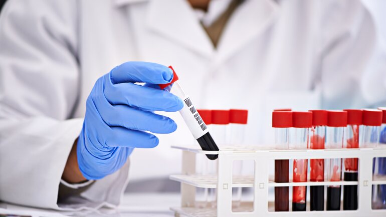 blutwerte fibrinogen