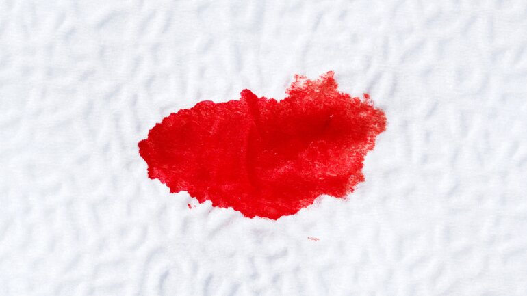 Blut im Stuhl