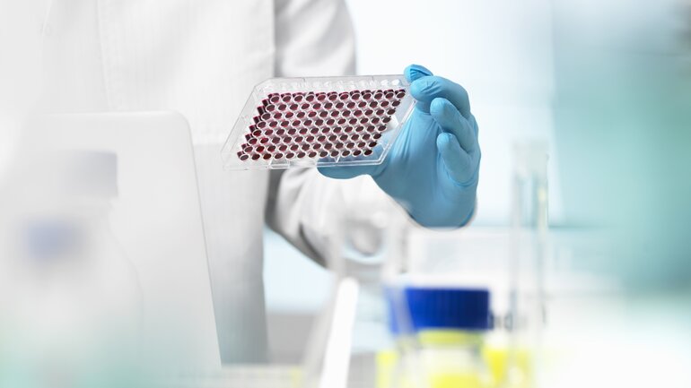 Erythrozyten: Erhöhte und erniedrigte Werte