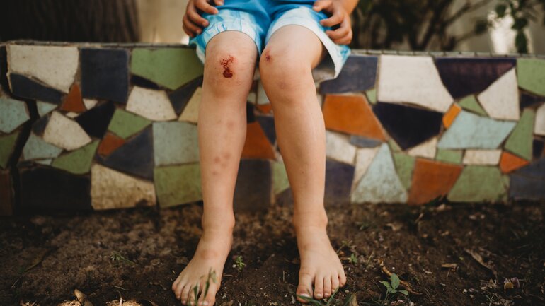 Thrombozyten – wichtig für die Wundheilung