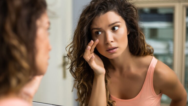 Cortisol zu hoch: Schwellungen im Bereich der Augen