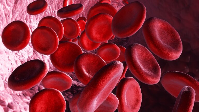 Stuhltests auf okkultes Blut sind ungenau
