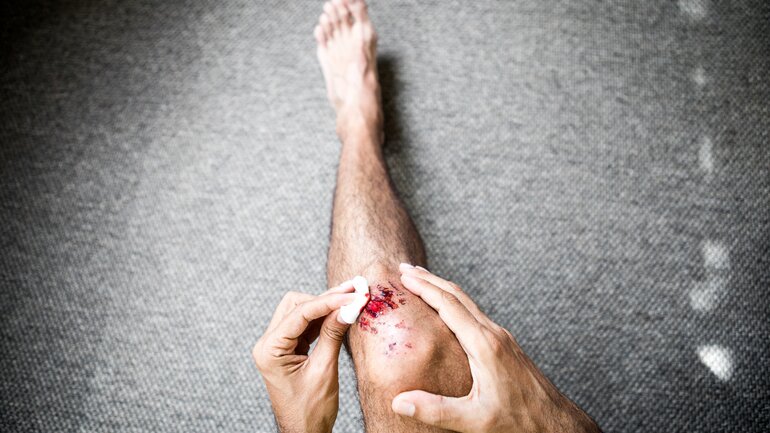 Schlechte Wundheilung: Symptom bei Diabetes