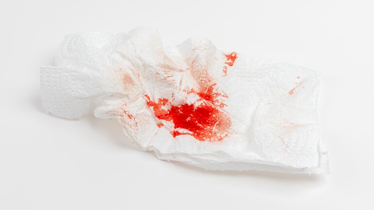 Blut im Sperma kann Alarmsignal sein