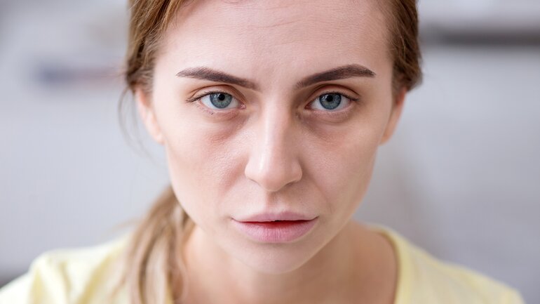 Eisenmangel: Blässe ist mögliches Symptom