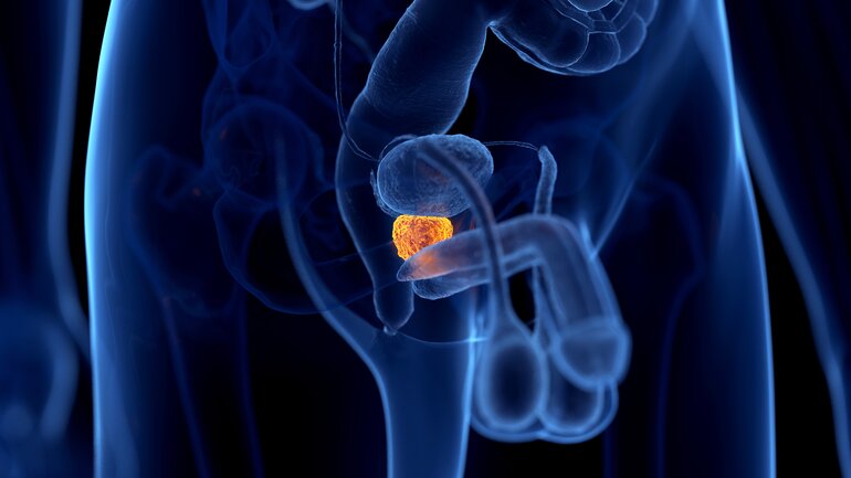 Die Prostata sitzt unter der Harnblase