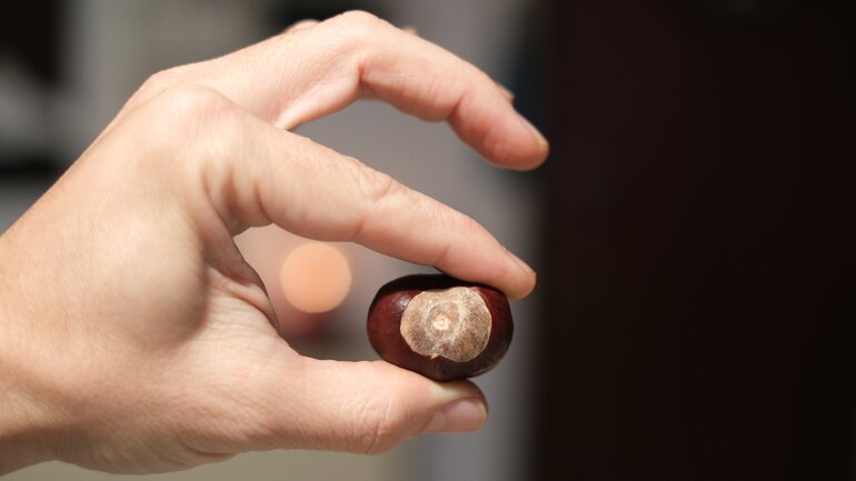 Die Prostata ist so groß wie eine Kastanie