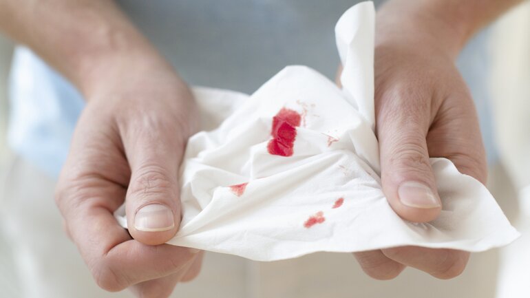 Blut im Stuhl ist Symptom bei Hämorrhoiden