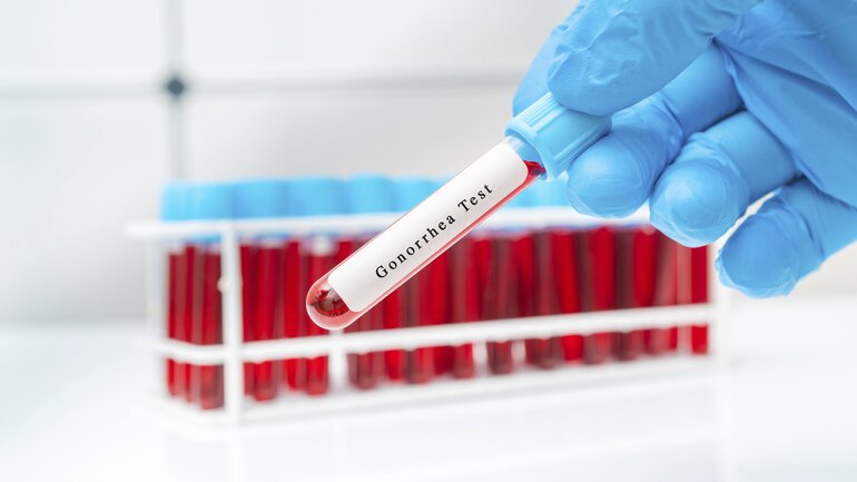 Gonorrhö: Infektion mit Gonokokken