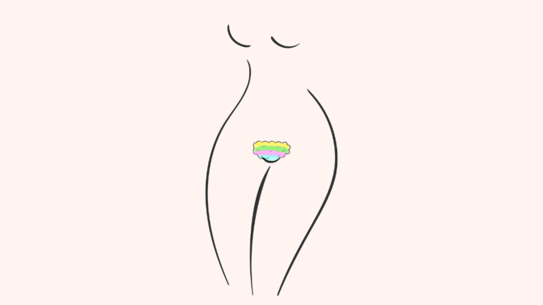 Bunte Intimfrisur