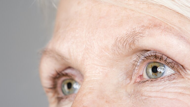 Neurodermitis: Ausgedünnte Augenbrauen als Symptom?