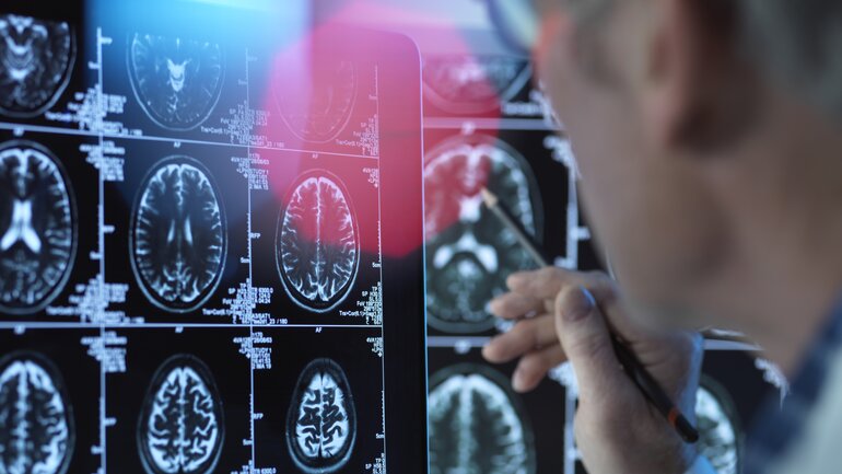 Neuropsychologische Therapie