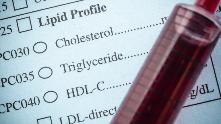 Erhöhte Blutfettwerte wie Cholesterin