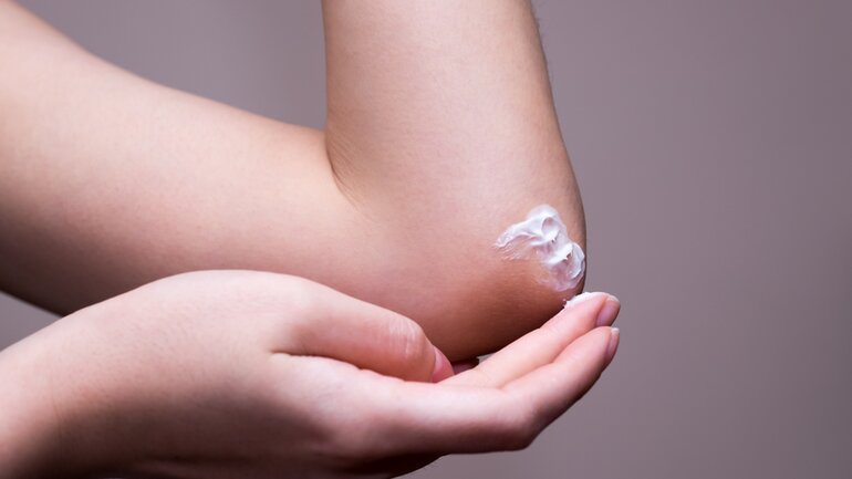 Trockene Haut als Symptom einer Hypothyreose