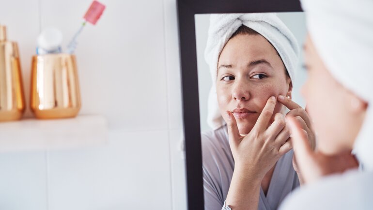 Schlechte Haut als Symptom für Stress