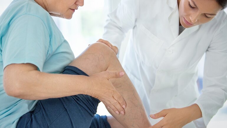 Thrombose: Geschwollene Venen sind Anzeichen