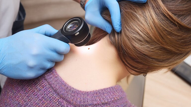 Arzt untersucht Warze am Hals von Patientin