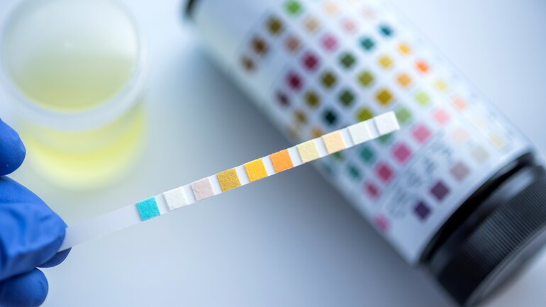 Teststreifen für Diabetes-Test