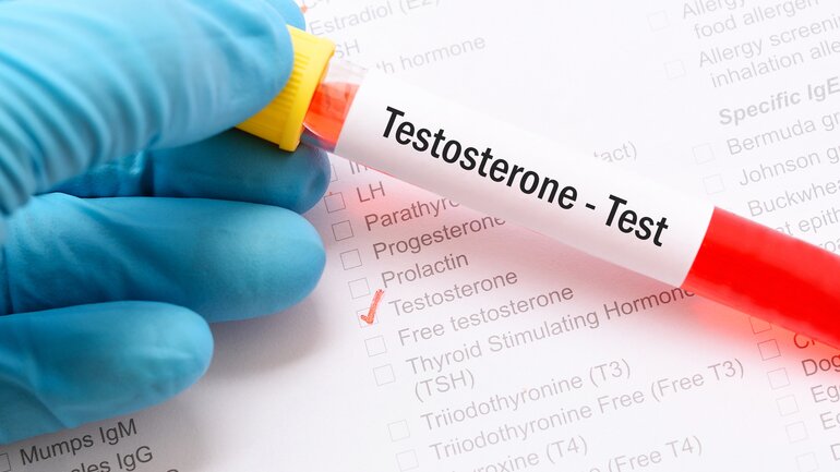 Testosteron - Test auf Hormonmangel