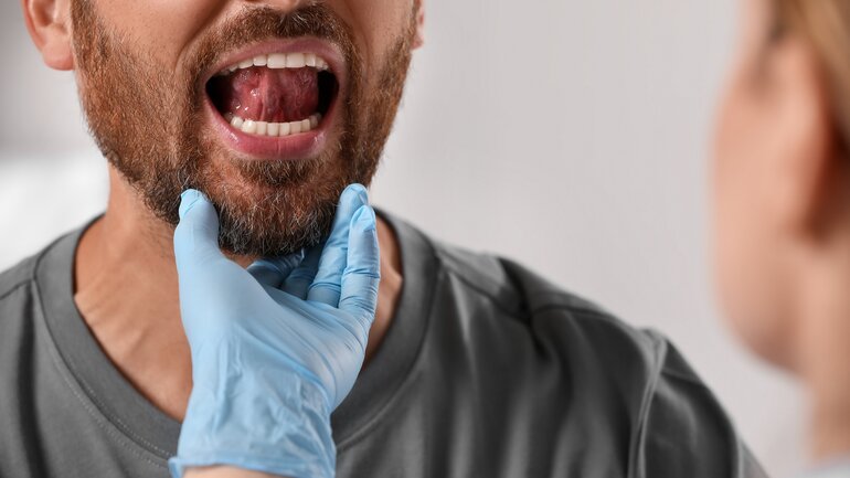 Ärztin untersucht die Zunge eines Patienten bei Verdacht auf Zungenkrebs